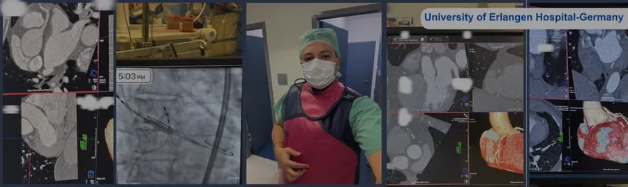 Advanced cardiac imaging at University Hospital Erlangen, Germany